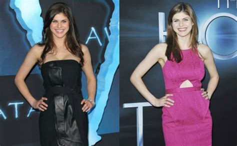 alexandra daddario breast reduction|Alexandra Daddario Breast Job – Before and After Pictures